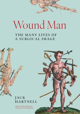 Cover Image for Wound Man: The Many Lives of a Surgical Image -- Jack Hartnell, Hardcover