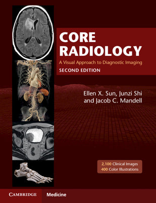 Cover Image for Core Radiology: A Visual Approach to Diagnostic Imaging -- Ellen X. Sun, Paperback