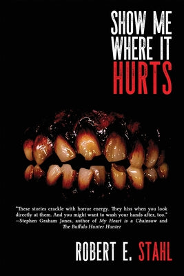 Cover Image for Show Me Where It Hurts -- Robert E. Stahl, Paperback