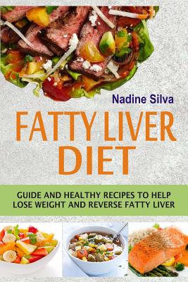 Cover Image for Fatty Liver Diet: Guide And Healthy Recipes To Help Lose Weight And Reverse Fatty Liver -- Nadine Silva, Paperback